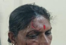 🟥 खेड तालुक्यात बिबट्याचा धुमाकूळ; कान्हेवाडी बुद्रुक येथे महिलेवर जीवघेणा हल्ला